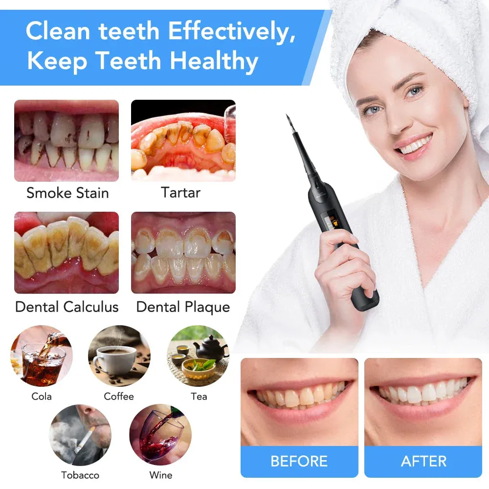 Electric Dental Scaler for Tartar and Stain Removal